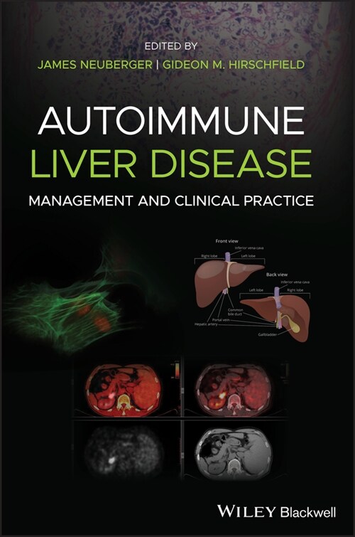 [eBook Code] Autoimmune Liver Disease (eBook Code, 1st)