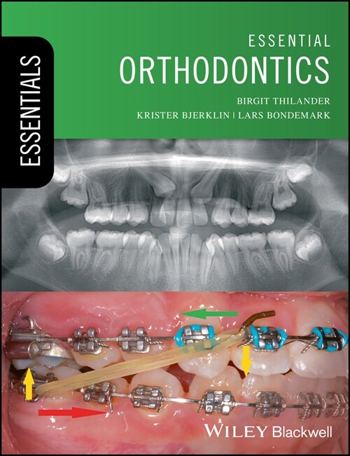 [eBook Code] Essential Orthodontics (eBook Code, 1st)
