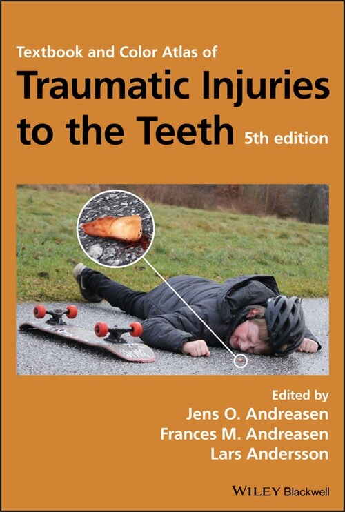 [eBook Code] Textbook and Color Atlas of Traumatic Injuries to the Teeth (eBook Code, 5th)