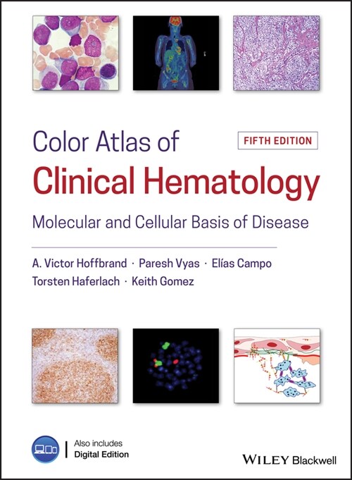 [eBook Code] Color Atlas of Clinical Hematology (eBook Code, 5th)