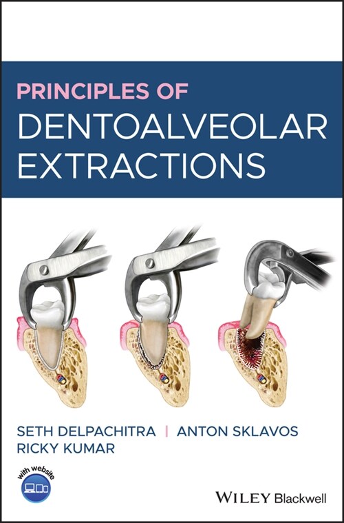 [eBook Code] Principles of Dentoalveolar Extractions (eBook Code, 1st)