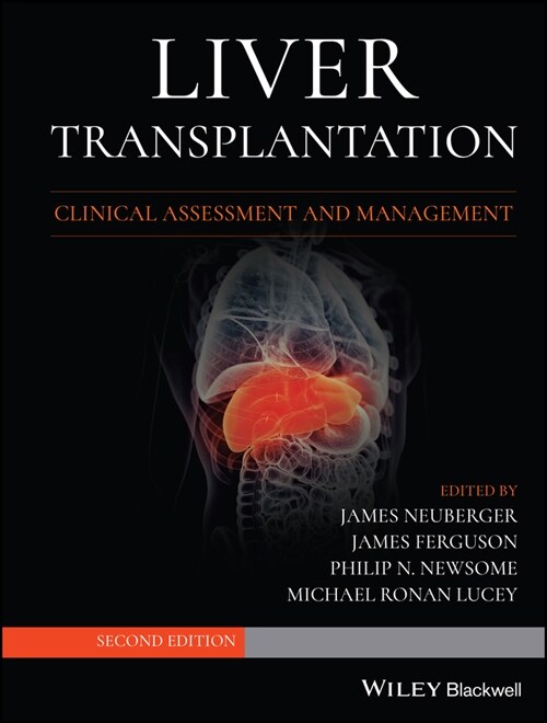 [eBook Code] Liver Transplantation (eBook Code, 2nd)