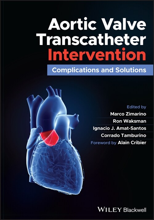 [eBook Code] Aortic Valve Transcatheter Intervention (eBook Code, 1st)