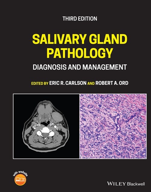 [eBook Code] Salivary Gland Pathology (eBook Code, 3rd)