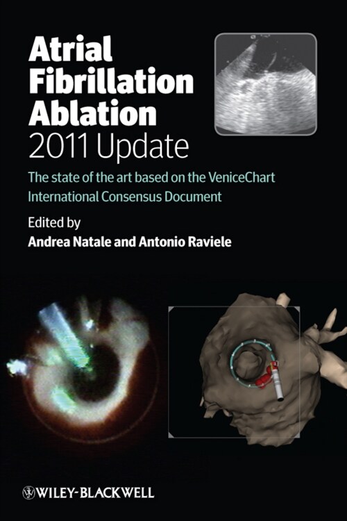 [eBook Code] Atrial Fibrillation Ablation, 2011 Update (eBook Code, 1st)