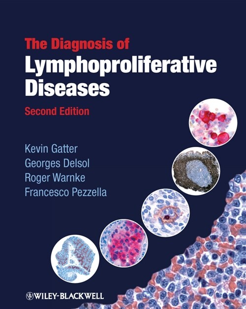 [eBook Code] The Diagnosis of Lymphoproliferative Diseases (eBook Code, 2nd)