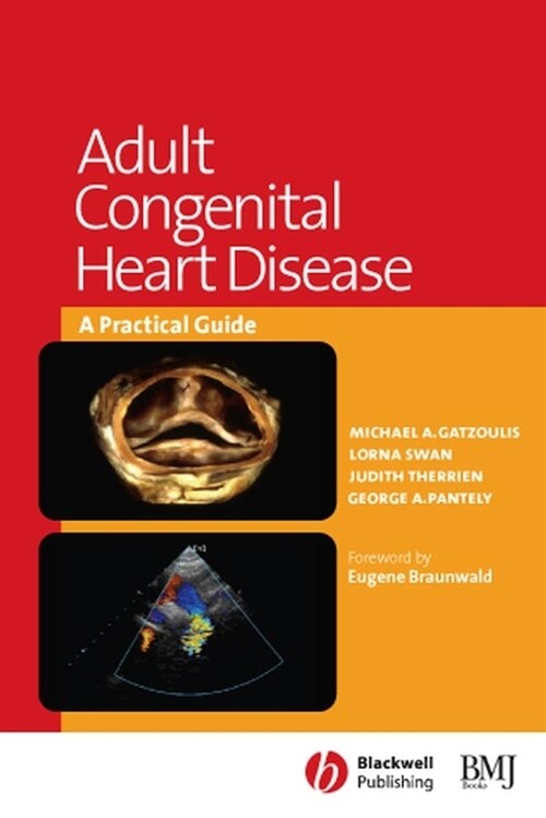 [eBook Code] Adult Congenital Heart Disease (eBook Code, 1st)