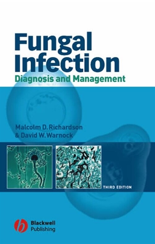 [eBook Code] Fungal Infection (eBook Code, 3rd)