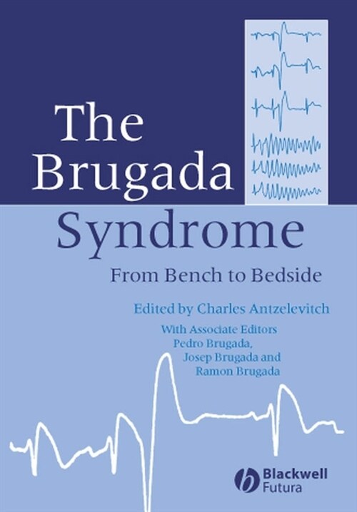 [eBook Code] The Brugada Syndrome (eBook Code, 1st)