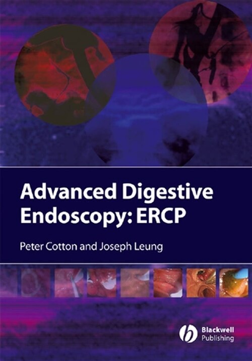 [eBook Code] Advanced Digestive Endoscopy (eBook Code, 1st)