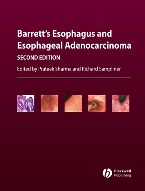 [eBook Code] Barretts Esophagus and Esophageal Adenocarcinoma (eBook Code, 2nd)