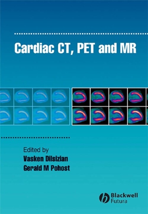 [eBook Code] Cardiac CT, PET and MR (eBook Code, 1st)