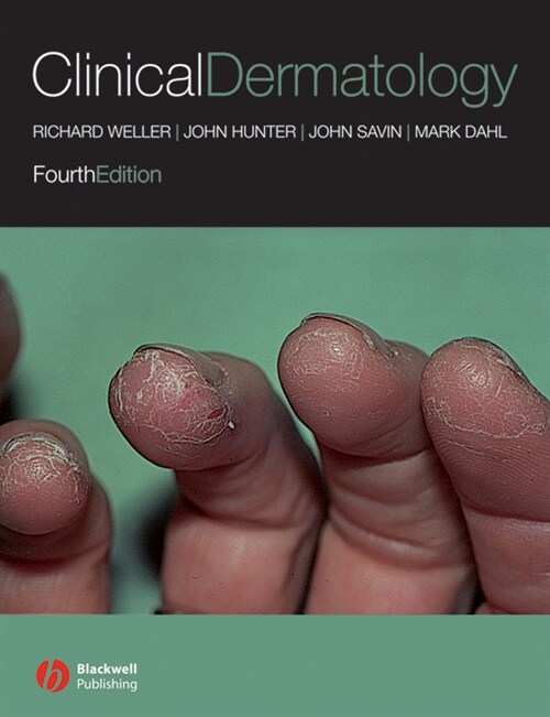 [eBook Code] Clinical Dermatology (eBook Code, 4th)