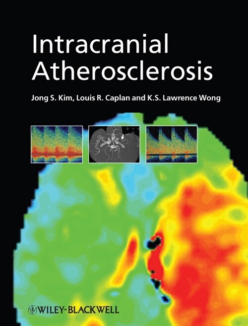 [eBook Code] Intracranial Atherosclerosis (eBook Code, 1st)