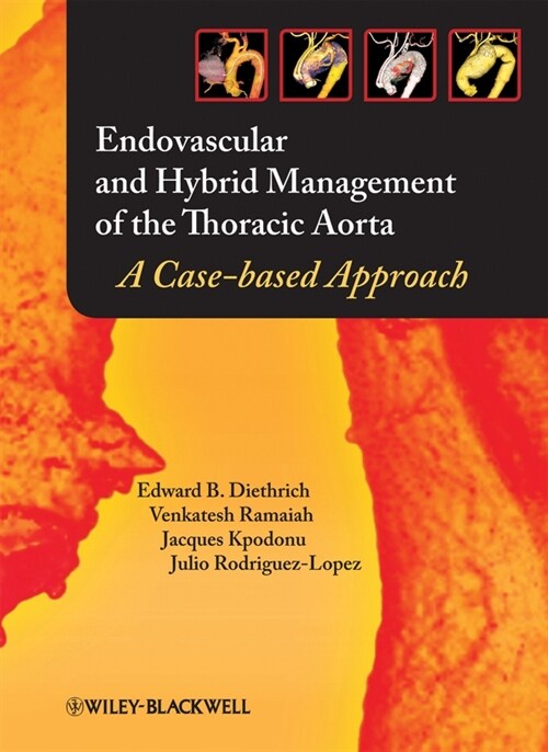 [eBook Code] Endovascular and Hybrid Management of the Thoracic Aorta (eBook Code, 1st)