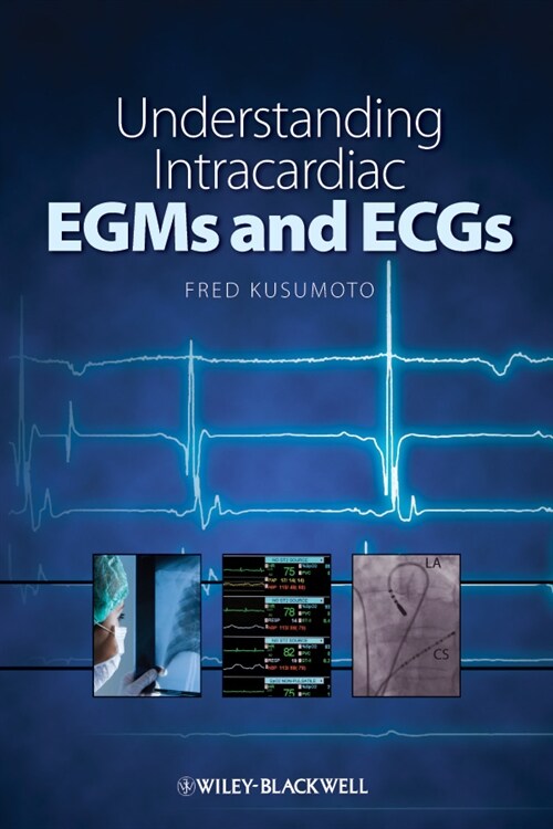 [eBook Code] Understanding Intracardiac EGMs and ECGs (eBook Code, 1st)