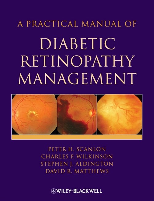 [eBook Code] A Practical Manual of Diabetic Retinopathy Management (eBook Code, 1st)