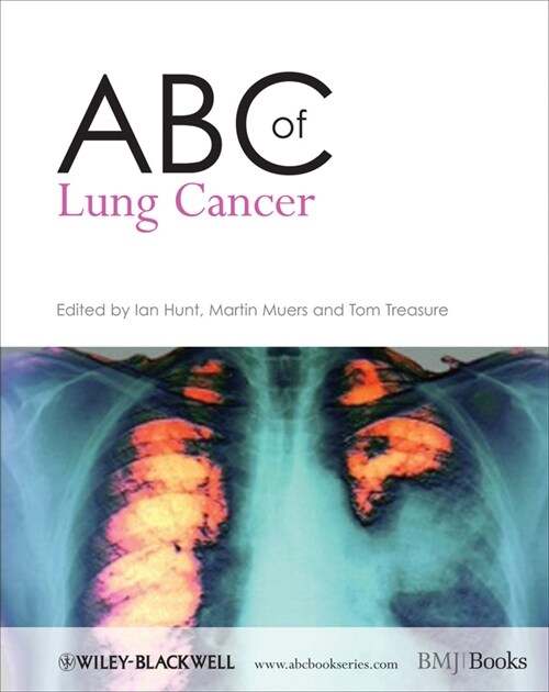 [eBook Code] ABC of Lung Cancer (eBook Code, 1st)