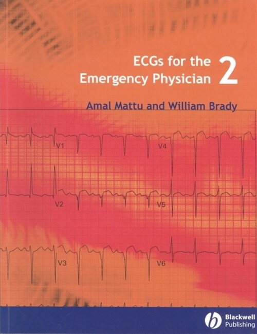 [eBook Code] ECGs for the Emergency Physician 2 (eBook Code, 1st)
