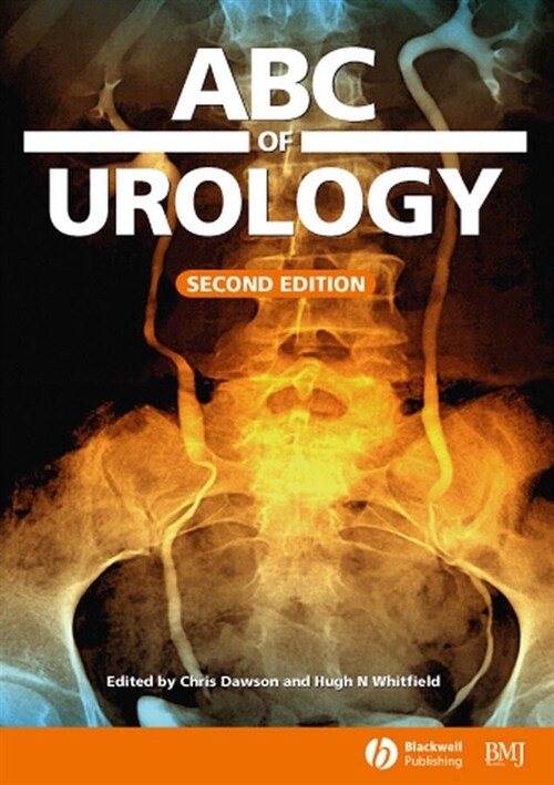 [eBook Code] ABC of Urology (eBook Code, 2nd)