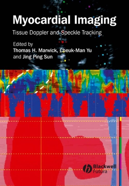 [eBook Code] Myocardial Imaging (eBook Code, 1st)