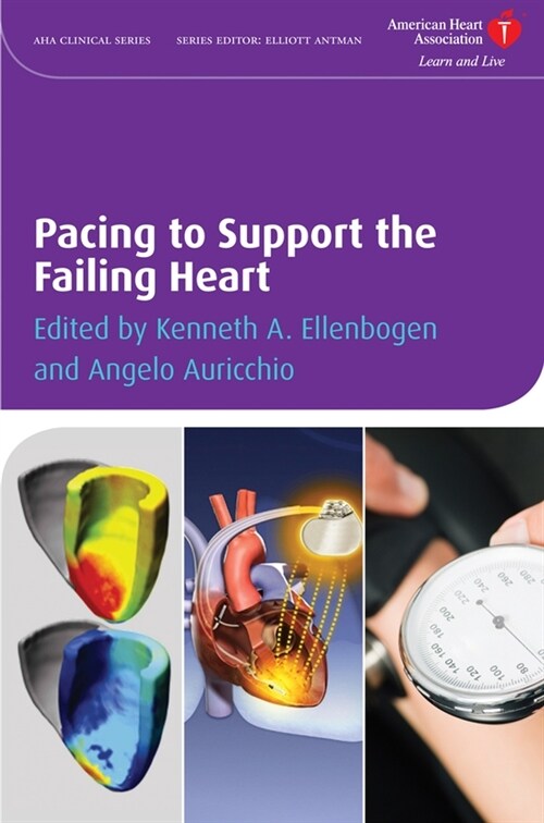 [eBook Code] Pacing to Support the Failing Heart (eBook Code, 1st)