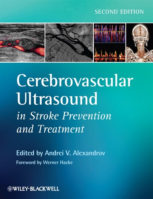 [eBook Code] Cerebrovascular Ultrasound in Stroke Prevention and Treatment (eBook Code, 2nd)