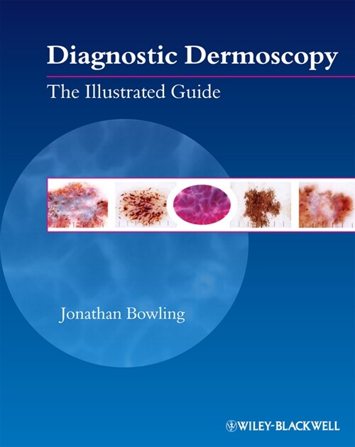 [eBook Code] Diagnostic Dermoscopy (eBook Code, 1st)