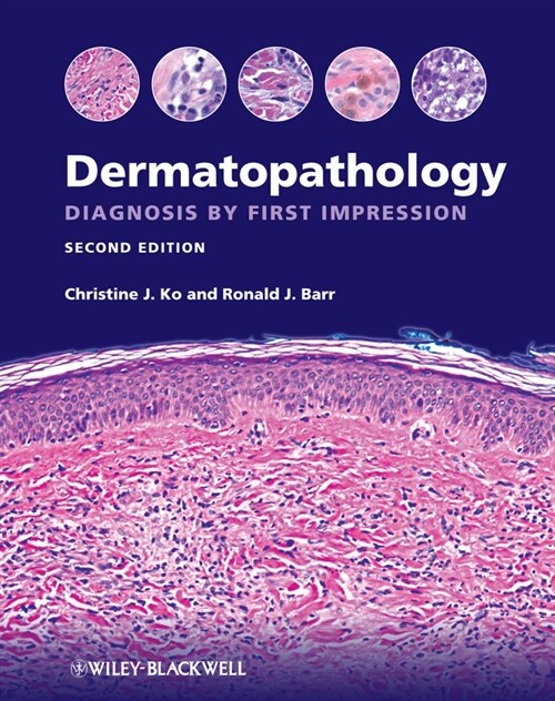 [eBook Code] Dermatopathology (eBook Code, 2nd)