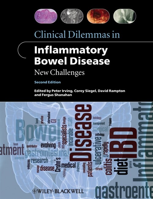 [eBook Code] Clinical Dilemmas in Inflammatory Bowel Disease (eBook Code, 2nd)