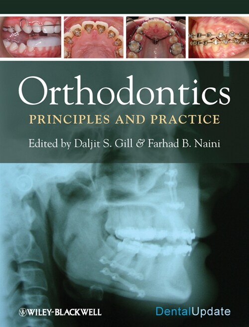 [eBook Code] Orthodontics (eBook Code, 1st)