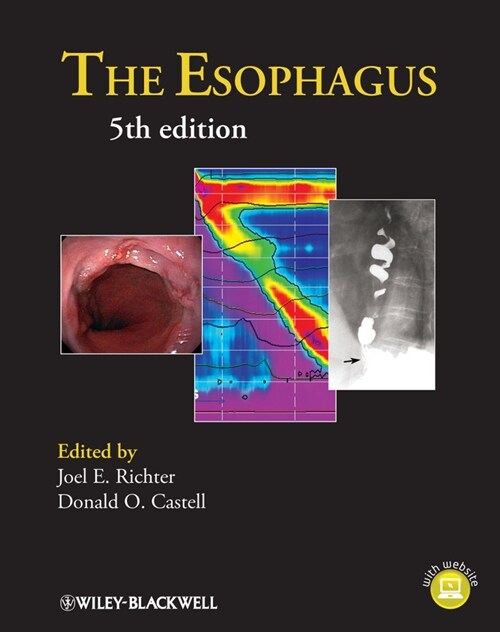[eBook Code] The Esophagus (eBook Code, 5th)