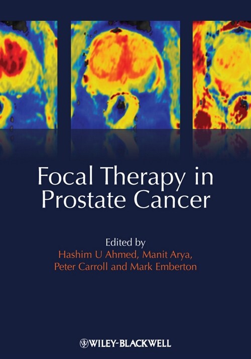 [eBook Code] Focal Therapy in Prostate Cancer (eBook Code, 1st)