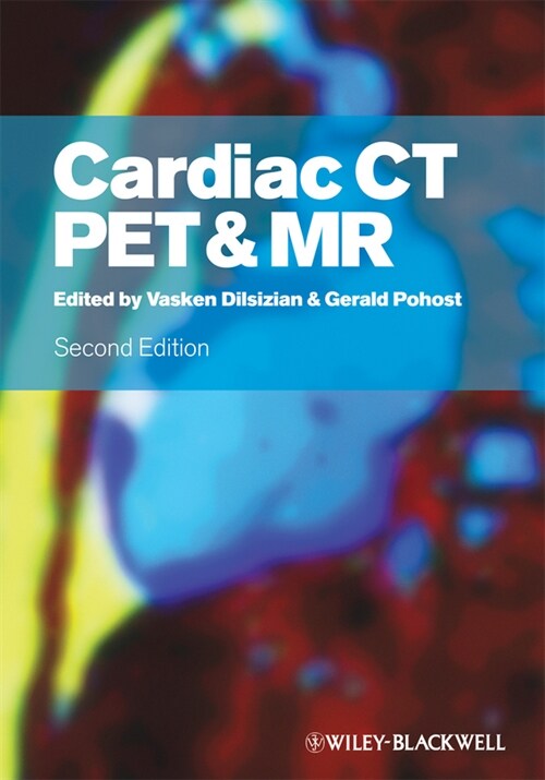 [eBook Code] Cardiac CT, PET and MR (eBook Code, 2nd)