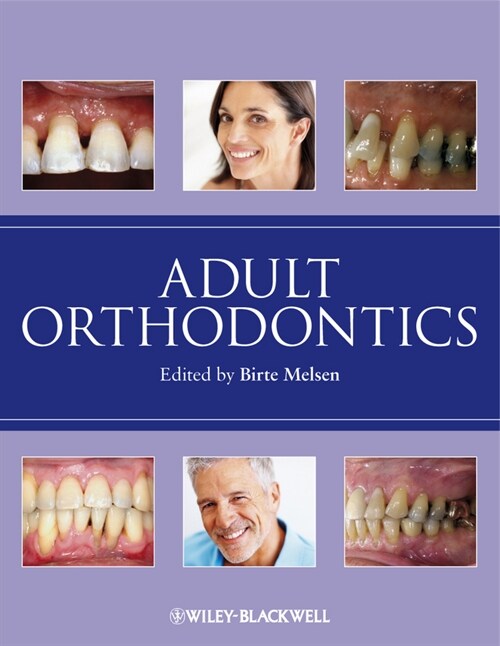 [eBook Code] Adult Orthodontics (eBook Code, 1st)