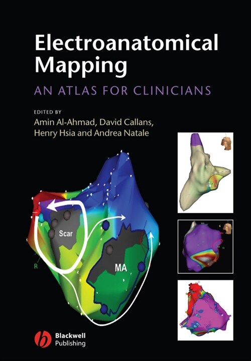 [eBook Code] Electroanatomical Mapping (eBook Code, 1st)
