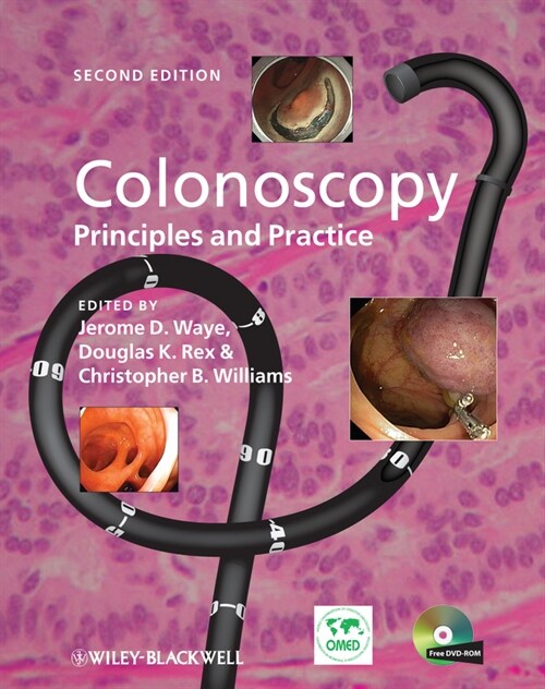 [eBook Code] Colonoscopy (eBook Code, 2nd)