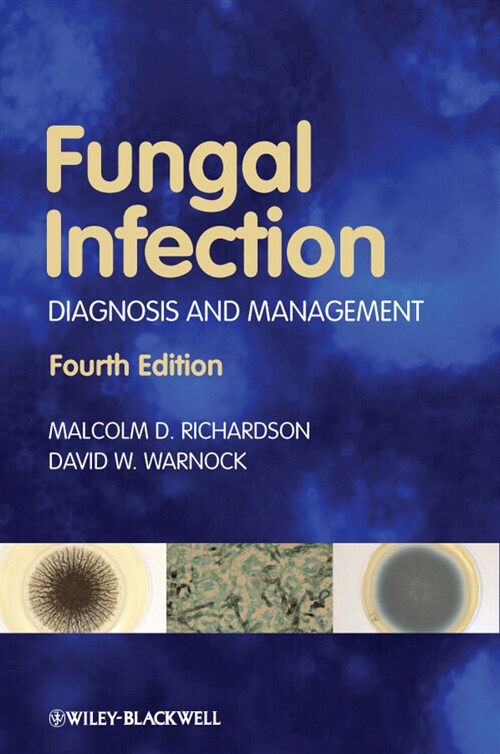 [eBook Code] Fungal Infection (eBook Code, 4th)