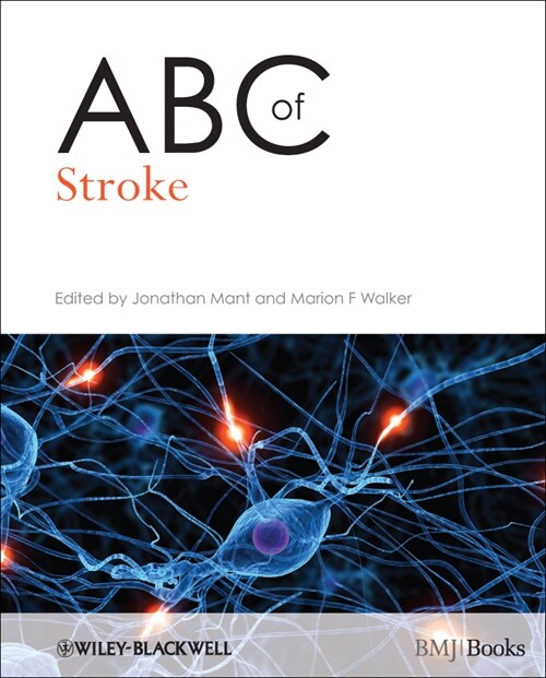 [eBook Code] ABC of Stroke (eBook Code, 1st)