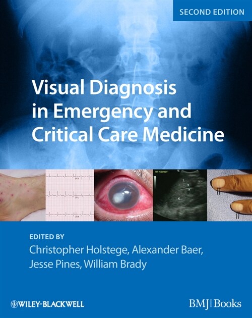 [eBook Code] Visual Diagnosis in Emergency and Critical Care Medicine (eBook Code, 2nd)