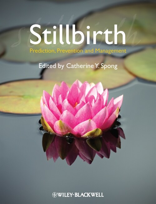 [eBook Code] Stillbirth (eBook Code, 1st)