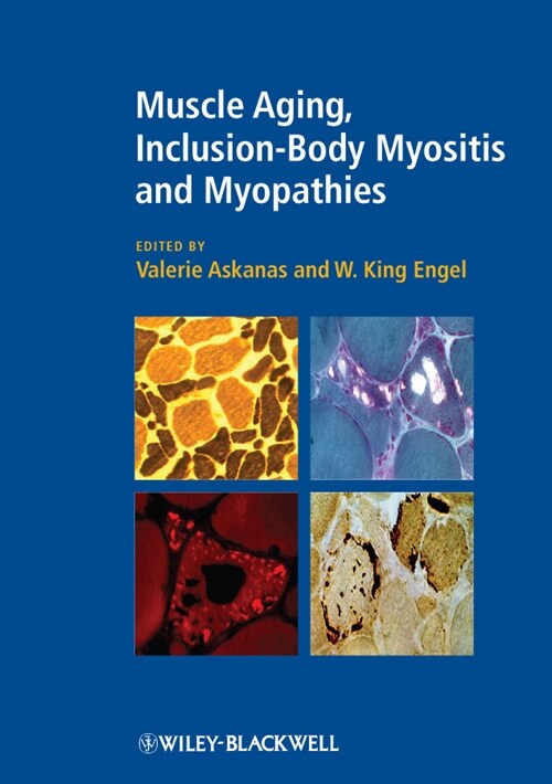 [eBook Code] Muscle Aging, Inclusion-Body Myositis and Myopathies (eBook Code, 1st)