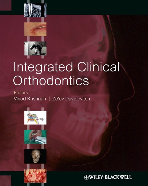 [eBook Code] Integrated Clinical Orthodontics (eBook Code, 1st)
