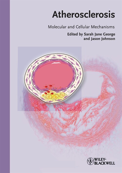 [eBook Code] Atherosclerosis (eBook Code, 1st)