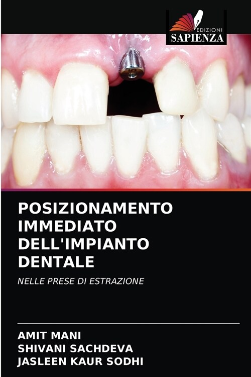 POSIZIONAMENTO IMMEDIATO DELLIMPIANTO DENTALE (Paperback)