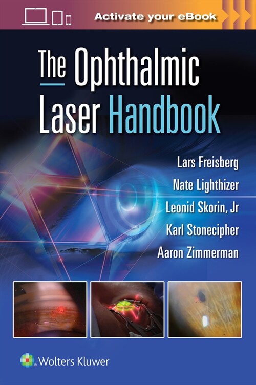 The Ophthalmic Laser Handbook (Paperback)