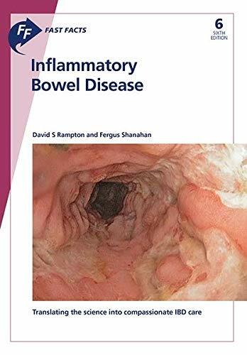 Fast Facts: Inflammatory Bowel Disease (Paperback)