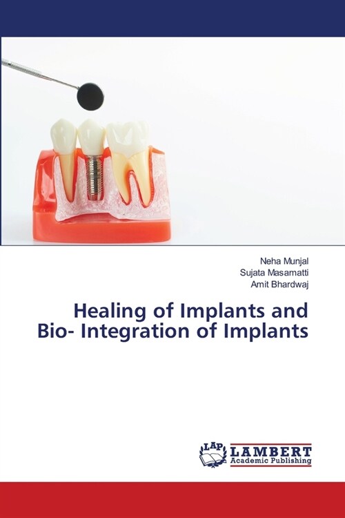 Healing of Implants and Bio- Integration of Implants (Paperback)