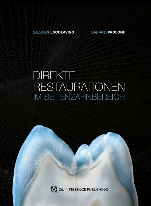 Direkte Restaurationen im Seitenzahnbereich (Hardcover)