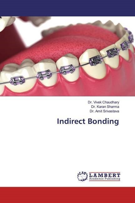 Indirect Bonding (Paperback)